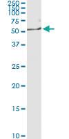 Anti-NEK2 Antibody Pair