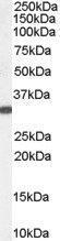 Anti-VDAC2 Goat Polyclonal Antibody