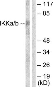 Western blot analysis of lysates from Jurkat cells using Anti-IKK alpha + beta Antibody. The right hand lane represents a negative control, where the antibody is blocked by the immunising peptide