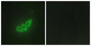 Immunofluorescence analysis of HepG2 cells using Anti-E2AK3 Antibody. The right hand panel represents a negative control, where the antibody was pre-incubated with the immunising peptide.