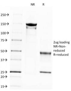 SDS-PAGE analysis of Anti-beta III Spectrin Antibody [SPTBN2/1583] under non-reduced and reduced conditions; showing intact IgG and intact heavy and light chains, respectively SDS-PAGE analysis confirms the integrity and purity of the antibody