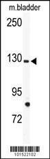 Anti-TIE1 Rabbit Polyclonal Antibody (Biotin)