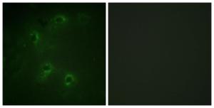 Immunofluorescence analysis of COS7 cells using Anti-DAPK1 Antibody. The right hand panel represents a negative control, where the Antibody was pre-incubated with the immunising peptide