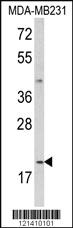 Anti-IL12A Rabbit Polyclonal Antibody