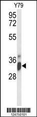 Anti-IMP4 Rabbit Polyclonal Antibody (APC (Allophycocyanin))