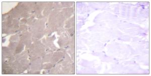 Immunohistochemical analysis of paraffin-embedded human skeletal muscle tissue using Anti-IKK alpha + beta Antibody. The right hand panel represents a negative control, where the antibody was pre-incubated with the immunising peptide