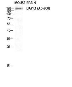 Western blot analysis of mouse brain cells using Anti-DAPK1 Antibody