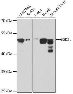 Western blot analysis of extracts of various cell lines, using Anti-GSK3 alpha Antibody (A12667) at 1:1,000 dilution