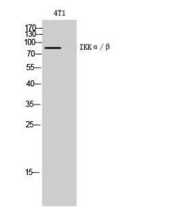 Western blot analysis of 4T1 cells using Anti-IKK alpha + beta Antibody