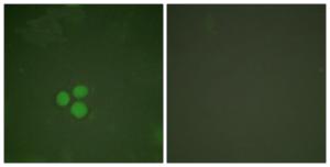 Immunofluorescence analysis of HeLa cells using Anti-DP-1 Antibody. The right hand panel represents a negative control, where the antibody was pre-incubated with the immunising peptide