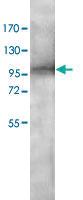 Anti-ADAMTS3 Rabbit Polyclonal Antibody