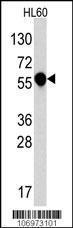 Anti-IL1R1 Rabbit Polyclonal Antibody (APC (Allophycocyanin))