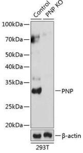 Western blot analysis of extracts from normal (control) and PNP knockout (KO) 293T cells, using Anti-Nucleoside phosphorylase Antibody (A307253) at 1:1000 dilution. The secondary Antibody was Goat Anti-Rabbit IgG H&L Antibody (HRP) at 1:10000 dilution