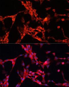 Immunofluorescence analysis of NIH/3T3 cells using Anti-GSK3 alpha Antibody (A12667) at a dilution of 1:100. DAPI was used to stain the cell nuclei (blue)