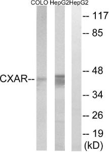 Western blot analysis of lysates from HepG2 and COLO cells using Anti-CXADR Antibody. The right hand lane represents a negative control, where the antibody is blocked by the immunising peptide