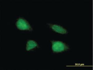 Anti-C19ORF43 Mouse Polyclonal Antibody