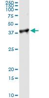 Anti-PCNA Antibody Pair