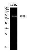 Anti-CD96 antibody