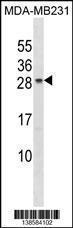 Anti-CHMP5 Rabbit Polyclonal Antibody (APC (Allophycocyanin))