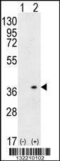 Anti-HLA-DQA1 Rabbit Polyclonal Antibody (AP (Alkaline Phosphatase))