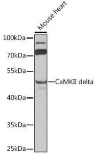 Western blot analysis of extracts of mouse heart, using Anti-CaMKII delta Antibody (A12669) at 1:1000 dilution