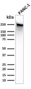 Western blot analysis of human PANC-1 cell lysate using Anti-beta III Spectrin Antibody [SPTBN2/1583]