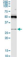 Anti-RASSF3 Mouse Monoclonal Antibody [clone: 3A5]