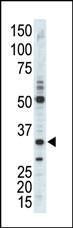 Anti-CDK1 Rabbit Polyclonal Antibody (PE (Phycoerythrin))