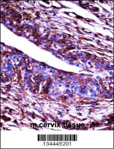 Anti-ADRBK2 Rabbit Polyclonal Antibody (APC (Allophycocyanin))