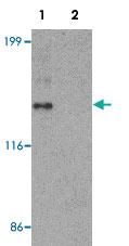 Anti-ZNF521 Rabbit Polyclonal Antibody