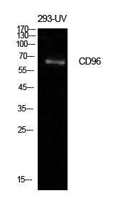 Anti-CD96 antibody