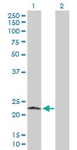 Anti-POLR2L Rabbit Polyclonal Antibody