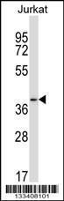 Anti-PAQR6 Rabbit Polyclonal Antibody