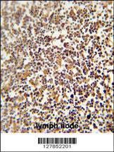 Anti-NRROS Rabbit Polyclonal Antibody (Biotin)