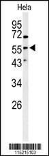 Anti-VIM Rabbit Polyclonal Antibody