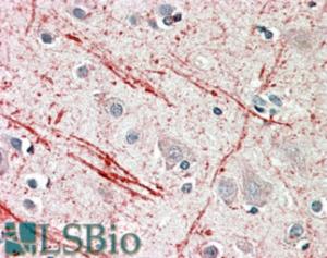 EB11063 (5 µg/ml) staining of paraffin embedded Human Cerebellum. Steamed antigen retrieval with citrate buffer pH 6, AP-staining.