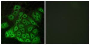 Immunofluorescence analysis of A549 cells using Anti-CSRL1 Antibody. The right hand panel represents a negative control, where the antibody was pre-incubated with the immunising peptide.