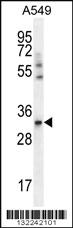 Anti-SLC25A6 Rabbit Polyclonal Antibody