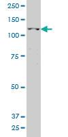 Anti-POLRMT Mouse Polyclonal Antibody