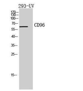 Anti-CD96 antibody