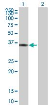 Anti-FOXS1 Mouse Polyclonal Antibody