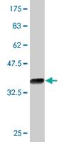 Anti-KLF12 Mouse Monoclonal Antibody [clone: 3E4]