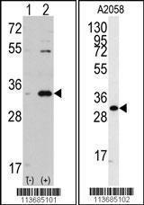 Anti-CDK1 Rabbit Polyclonal Antibody (APC (Allophycocyanin))