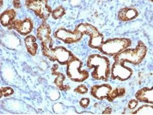 Immunohistochemical analysis of formalin-fixed, paraffin-embedded human renal cell carcinoma tissue using Anti-AMACR Antibody [13H4]