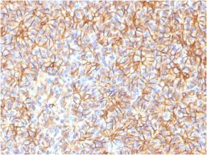 Immunohistochemical analysis of formalin-fixed, paraffin-embedded human pancreas using Anti-beta III Spectrin Antibody [SPTBN2/1584]