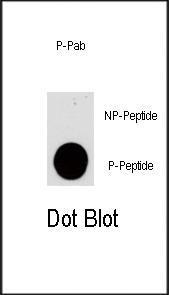 Anti-PIK3CG Rabbit Polyclonal Antibody (AP (Alkaline Phosphatase))