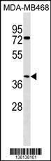 Anti-ABHD1 Rabbit Polyclonal Antibody (APC (Allophycocyanin))