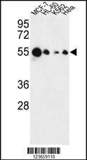 Anti-AIM2 Rabbit Polyclonal Antibody (FITC (Fluorescein Isothiocyanate))