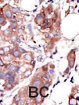 Anti-MUSK Rabbit Polyclonal Antibody (PE (Phycoerythrin))