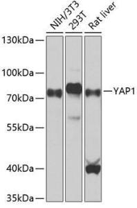 Western blot analysis of extracts of various cell lines, using Anti-YAP1 Antibody (A308260) at 1:1,000 dilution. The secondary antibody was Goat Anti-Rabbit IgG H&L Antibody (HRP) at 1:10,000 dilution.